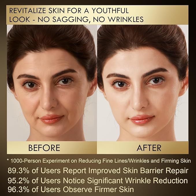 US-Made With 30% active IngredientsSGS Certified Retinol Vitamin C Niacinamide CeramideOligopeptidesAnti-Aging Face Moisturizer for Face Firming Skin CareNeck &amp Upper Chest -1.7 fl.oz