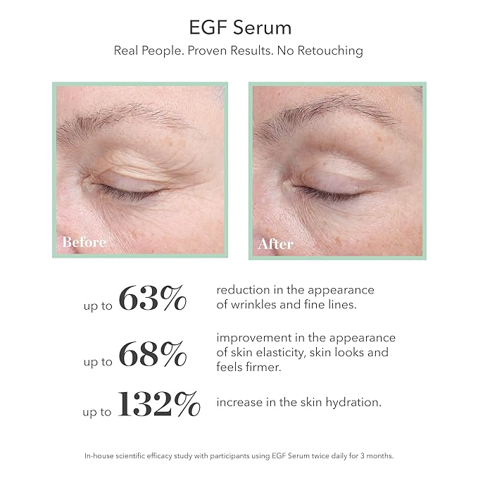BIOEFFECT EGF Serum Treatment Duo with Hyaluronic Acid Enhance Skin with Moisturizing Firming Wrinkle-Fighting Treatment for Face And Neck Day And Night Best Derma Roller Facial Serum