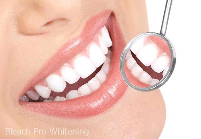 Teeth Whitening Gel Syringe Dispensers 22% Carbamide Peroxide 10 Tooth Bleaching Gel 3ml Syringes