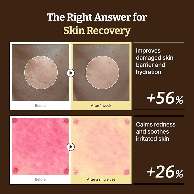 Dr. Reju-All Advanced PDRN Rejuvenating Cream ? 99% Pure Salmon DNA PDRN Face Moisturizer ? Optimal 1200ppm Concentration for Glow Skin ? Korean Anti-Aging Skin Care Face Cream - 2.0 Fl Oz