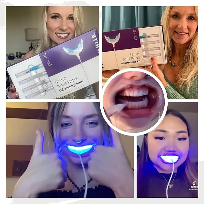 Professional Teeth Whitening Kit LED Accelerator Light 36% Carbamide Peroxide Teeth Whitening Gel 20 Whitening Treatments Remineralizing Gel USA-Made Gels