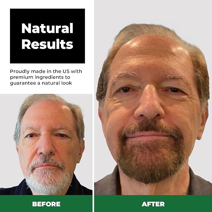 Simpler Hair Color Medium Brown Mustache and Beard Upgraded Brush Kit it with 3 Brushes Included for Precision Application - Gentle Effortless 100% Gray Hair Coverage for Hair and Beard