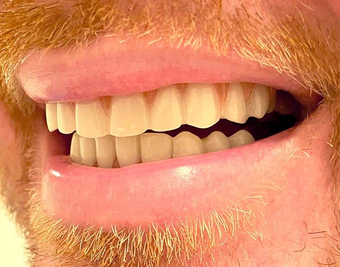 Instant Smile Comfort Fit Flex Teeth - Upper and Lower Matching Set Natural Shade! Fix Your Smile at Home Within Minutes!