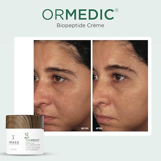 IMAGE Skincare ORMEDIC Biopeptide Cr?me Balancing Face Moisturizer with Shea Butter Hyaluronic Acid and Organic Plant Oils 2oz