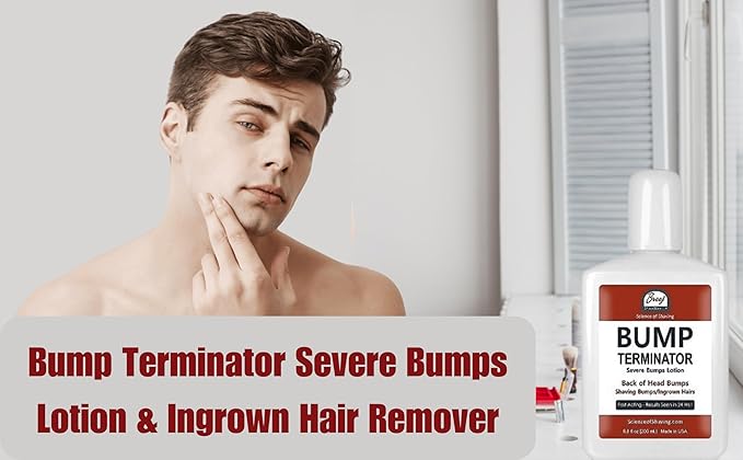 BUMP Terminator Razor Bumps &amp Shaving Bumps Remover | Ingrown Hair Treatment for Pubic Area with Glycolic Acid Salicylic acid &amp Tea Tree Oil| BREEJ Bump Treatment for Bikini Bumps 6.8 oz (Pa