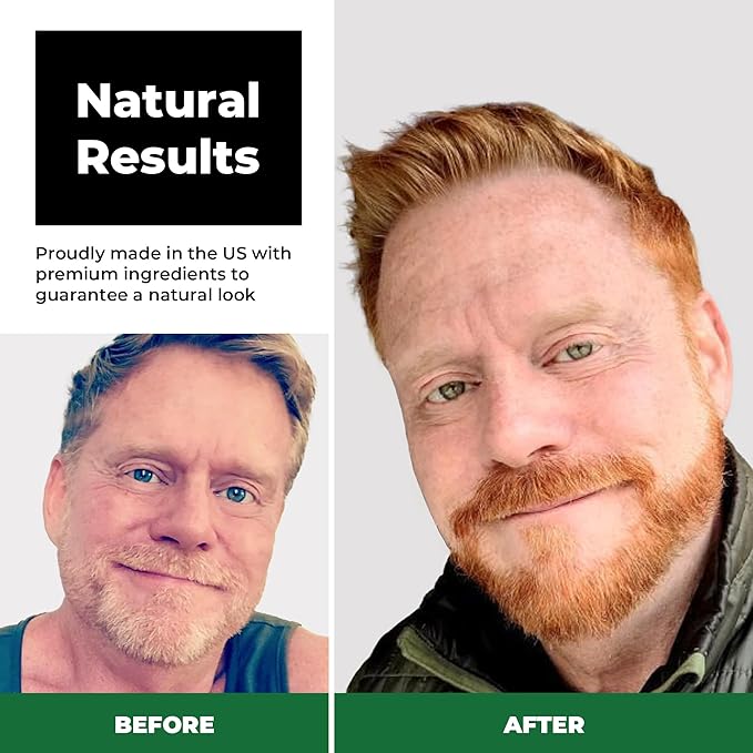Simpler Hair Color Ginger Mustache and Beard Upgraded Brush Kit with 3 Brushes Included for Precision Application - Gentle Natural Looking Ammonia Free Beard and Hair Dye for Men