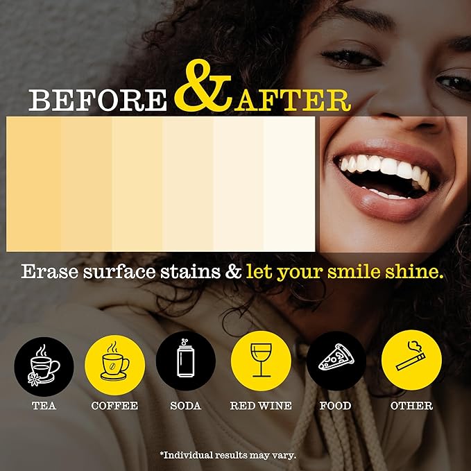 Twice Twice Teeth Whitening Strips ? 20-Day Treatment 30-Mins Quick Whitening No-Slip Mess Free Easy to Use Sweet Mint Flavor Vegan Gentle Whitening Designed with Care for a Brighter Smile