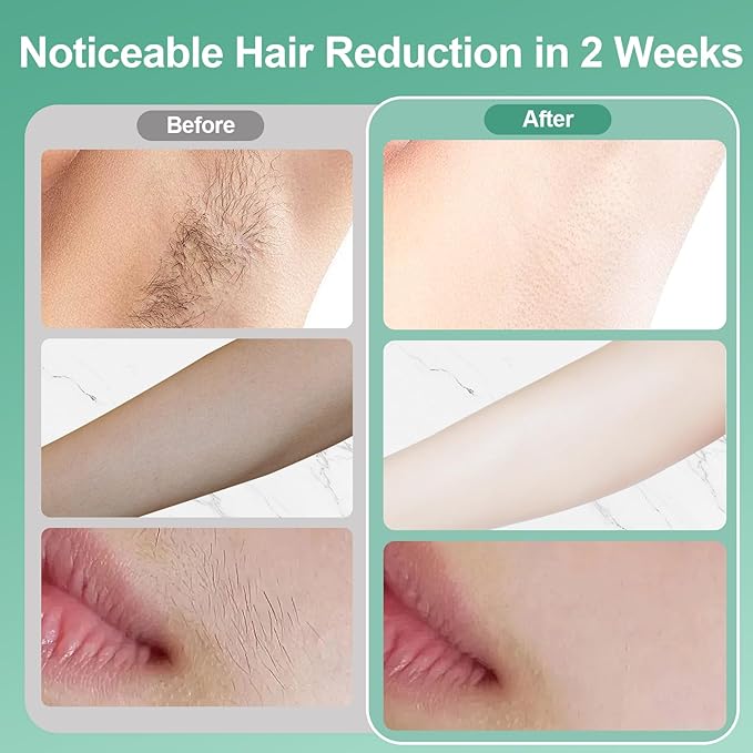 Sapphire Ice Cooling Hair Remove Device Ice-cooling Device Hair Removal for Nearly Painless Auto Flashing for Fast Full Body Hair Removal White