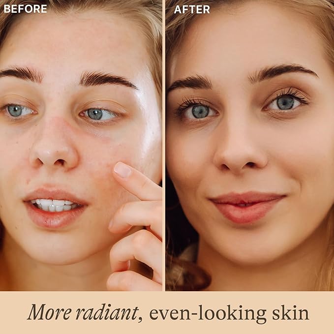 Vitamin C Face Serum - USA Made with Natural &amp Organic Ingredients Skin Brightening Vitamin C Serum for Face for Women Discoloration Correcting &amp Anti Aging Facial Formula with Antioxidants