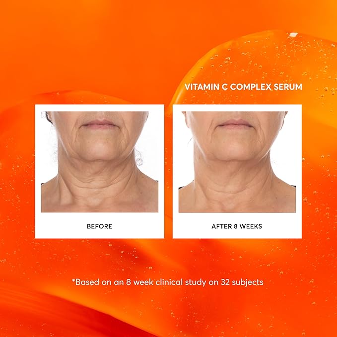 Naturium Vitamin C Complex Face Serum Anti-Aging Facial Treatment with Hyaluronic Acid &amp Vitamin E 1 oz