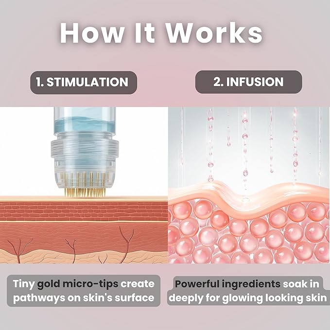 Glov Beauty Micro Infusion System for Face &amp Lips ? 0.25mm 24k Gold Cosmetic Facial Stamp with Hyaluronic Acid Collagen Peptides &amp Licorice Root Serum Ampoules (2x Infusion Application 6x Se