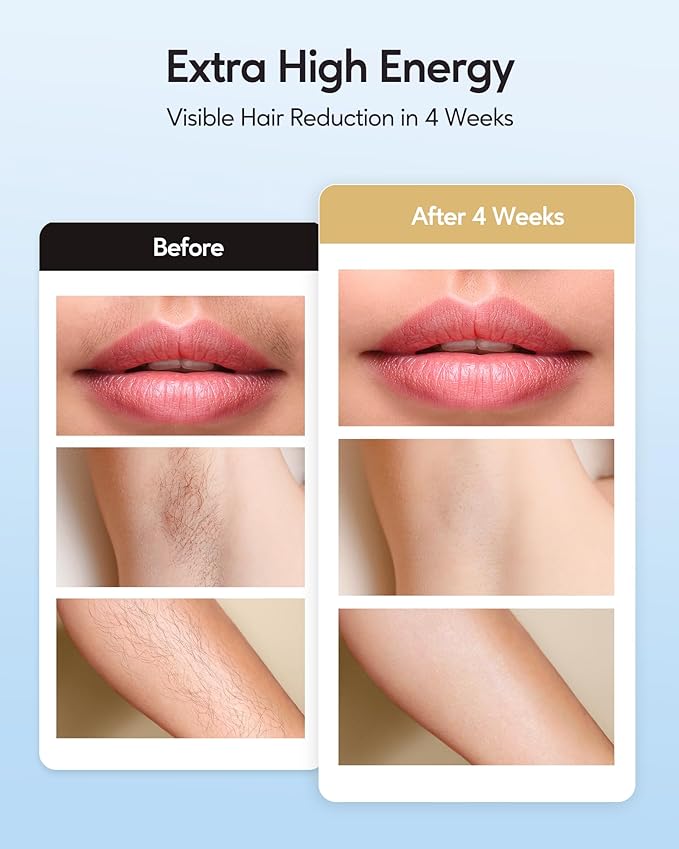 INNZA IPL Hair Removal with Ice Cooling Care Function for WomenLong-Lasting Results999999 Flashes Painless IPL Hair Remover Hair Removal Device for Armpits Legs Arms Bikini Line