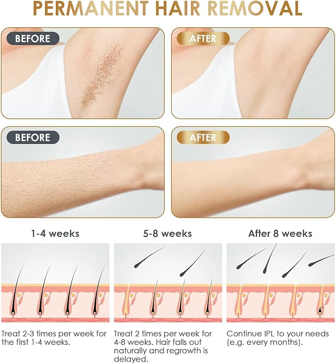 IPL Laser Hair Removal Device at-Home for Women Men NATRSYM Painless Permanent Facial Upper Lip Bikini Line Armpits Back Legs Arms Face Back Whole Body Remover
