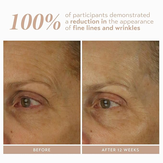 SHANI DARDEN SKIN CARE Retinol Reform with 1% Encapsulated Retinol Serum for Face &amp Neck Gentle Slow-Release Retinol Face Serum with Tripeptide for Wrinkles Fine Lines &amp Uneven Tone 0.3 fl