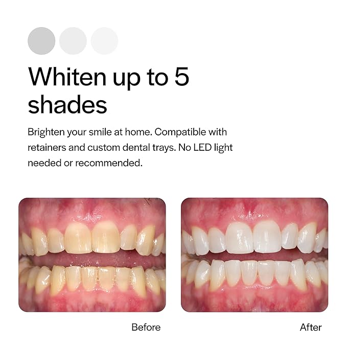 Opalescence 20% Teeth Whitening Refill Kit (4 Syringes) Carbamide Peroxide. Made by Ultradent in Mint Flavor. Tooth Whitening Refill Syringes - B-5196-4