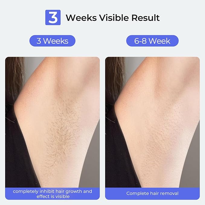 Laser Hair Removal IPL Laser Hair Removal Device for Women &amp Men Home 41°FSapphire Ice-Cooling Nearly Painless Safe and Long-Lasting Hair Removal for Full Body &amp Face Unlimited Flashes
