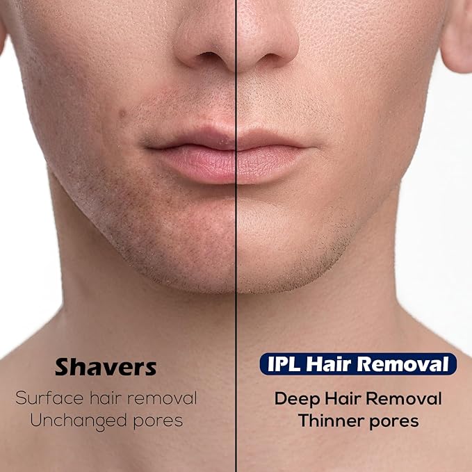 IPL Hair Removal Whole Body Hair Removal for Men and Women at Home Pain-Free &amp Long-Lasting for Body &amp Face Hair Removal Effective in 2 Weeks with Ultra-Fast 0.2S Light Emission(Green)
