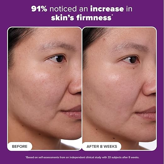 Paula's Choice CLINICAL 1% Retinol Face Moisturizer Treatment with Peptides Vitamin C &amp Licorice Extract Firming Face Cream Anti-Aging &amp Wrinkles Fragrance Free
