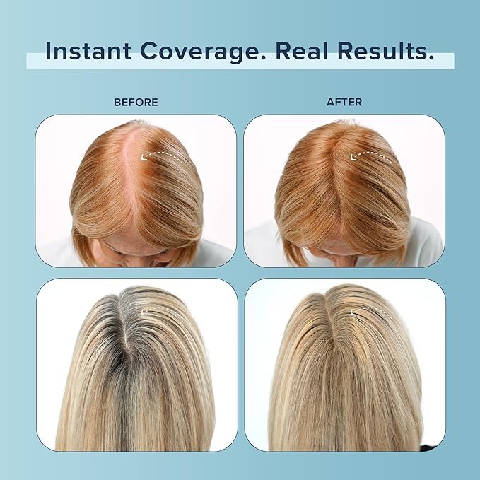 TRUHAIR Color Fibers Root Coverage and Density Booster Refill | Quick-Apply Touch Up Hair Color | Natural Matching Gray Hair Cover Up - 11 Colors Available (Medium Brown)