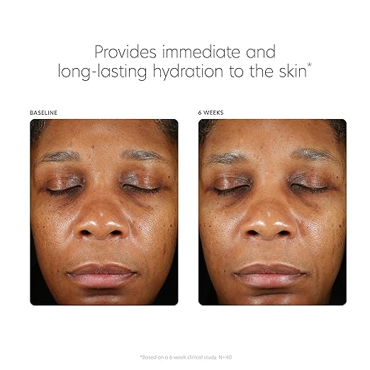 PCA SKIN Hyaluronic Acid Boosting Face Serum Hyaluronic Acid Serum for Face Made with Niacinamide and Ceramides Helps Reduce Fine Lines and Wrinkles and Delivers 24-Hour Moisturization 1 oz Pump