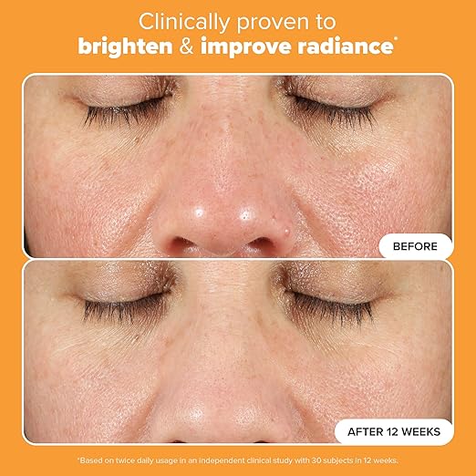 Paula's Choice BOOST C15 Super Booster 15% Vitamin C Serum for Face Face Serum with Vitamin E &amp Ferulic Acid for Discoloration &amp Glow Fragrance-Free 0.67 Fl Oz