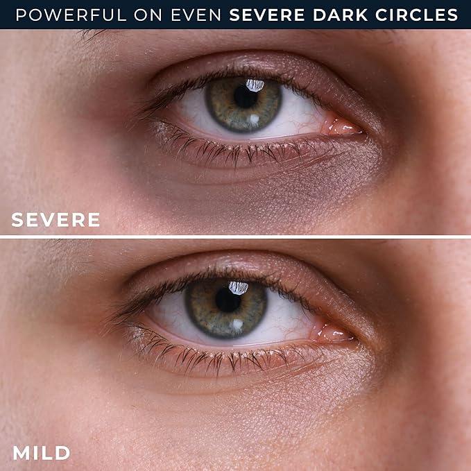 RoC Derm Correxion Retinol Eye Repair Dark Circle Cream Treatment with Niacinamide Resveratrol Proxygen for puffy eyes wrinkles and crow's feet with Line Smoothing Eye Packette