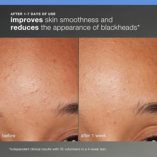 Dermalogica Discover Healthy Skin Kit - Includes: Precleanse Face Wash Face Exfoliator &amp Moisturizer - Wash Away Impurities To Reveal Glowing Skin
