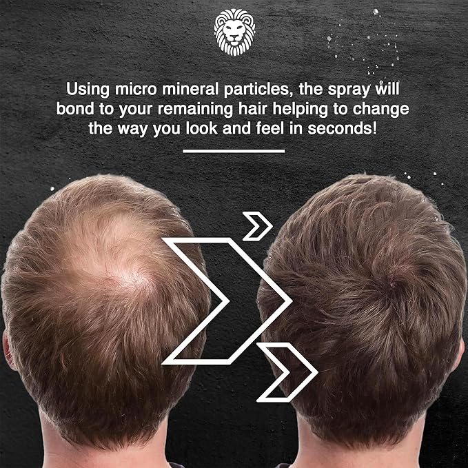 Mane Hair Thickening Spray &amp Root Touch Up Instantly Thicker Hair for Men &amp Women Fill in Hairlines and Hide Thinning and Fine Patches - Auburn 12 Colors (6.76 oz)