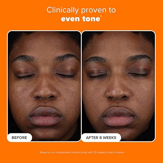 Paula?™s Choice 25% Vitamin C Serum with Glutathione &amp Antioxidants Face Serum Improves Discoloration Uneven Tone &amp Firms All Skin Types Fragrance-Free 1oz