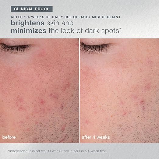 Dermalogica Your Moment of Expertise ? Expert Level Skin Care Routine Set Includes 6 Products Headband Gua Sha Fan Brush