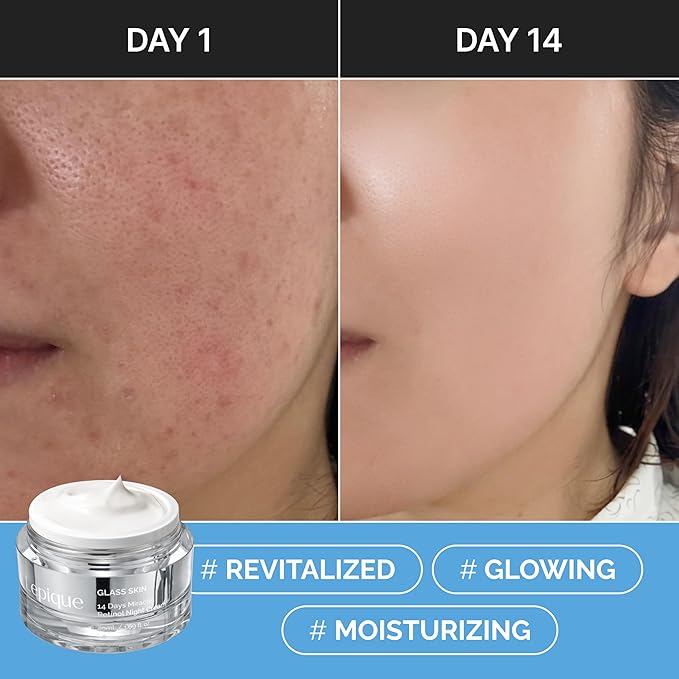 Retinol Night Cream 1.69oz - No.1 Korean Premium Overnight Repair Cream for Face and Neck - Collagen Centella Hyaluronic Acid - Anti aging Acne Moisturizer Face Cream Hydrating Firming