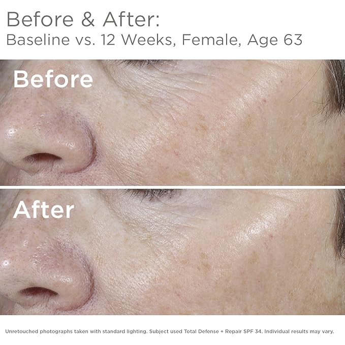 SkinMedica Total Defense + Repair SPF 34 Sunscreen for Face. This Lightweight Facial Sunscreen is Ideal for Oily and/or Combination Skin 2.3 Oz