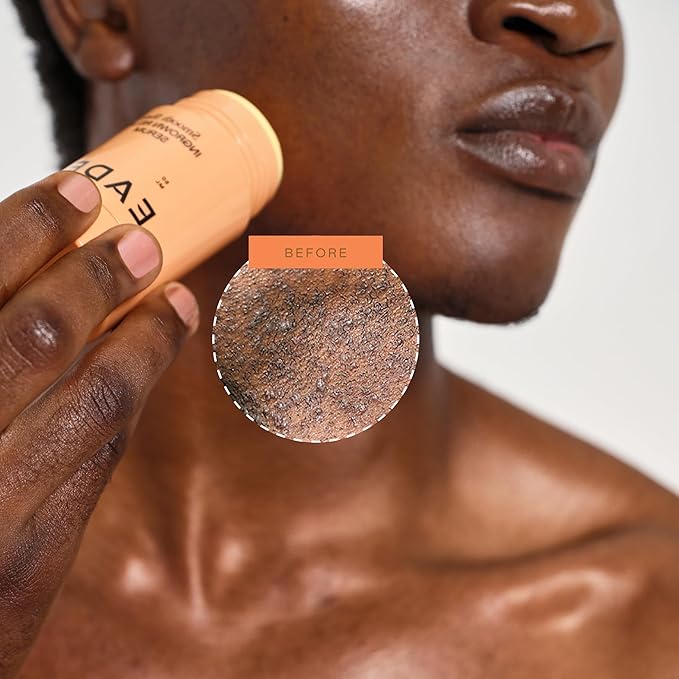 EADEM Smooth Slate Ingrown Hair Roller Serum Targets Bumps Trapped Hairs Faded Topicals for Scarring and Dark Spots AHAs and Tyrosinase Slows Ingrown Hair Regrowth