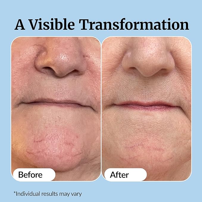 Vibriance Super C Serum for Mature Skin - All-in-One Vitamin Formula Hydrates Firms Lifts Smooths Targets Age Spots Wrinkles 1 fl oz - Pack of 3