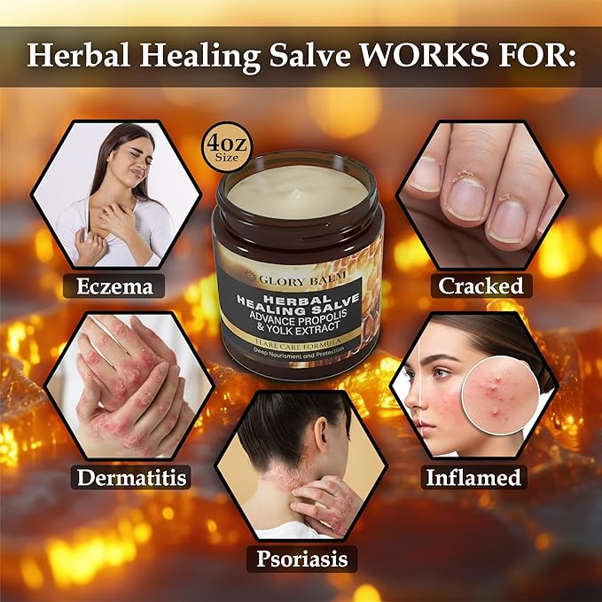 Herbal Healing Salve | Skin Flare Care Relief Formula | Propolis &amp Egg Yolk Extract | Mango Butter Grapeseed Oil Beeswax | Unscented 4oz