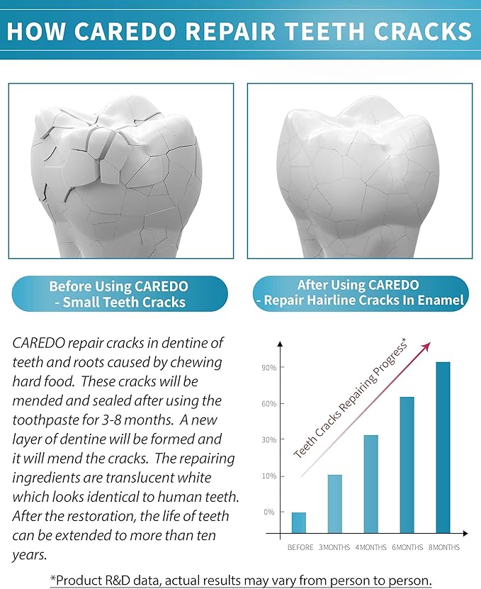 Healing Teeth Crack Toothpaste The ONLY Toothpaste Repairing Cracked Teeth Enamel Cracks Cure Tooth Sensitivity Remove Pigment in Crack 100g 2 Counts As Mother's Day Gift