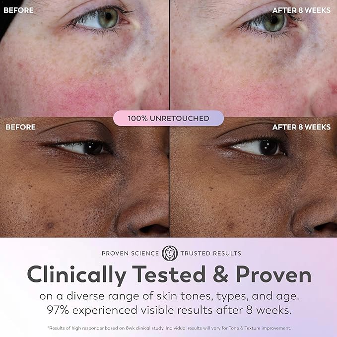 Olay Super Serum - Niacinamide Vitamin C &amp E Collagen Peptide AHA - 5-in-1 Skin Care Benefits for Face - Healthy Glow Brightening Hydrating Smoothing Firming Evens Tone Anti-Aging 1.7 Oz