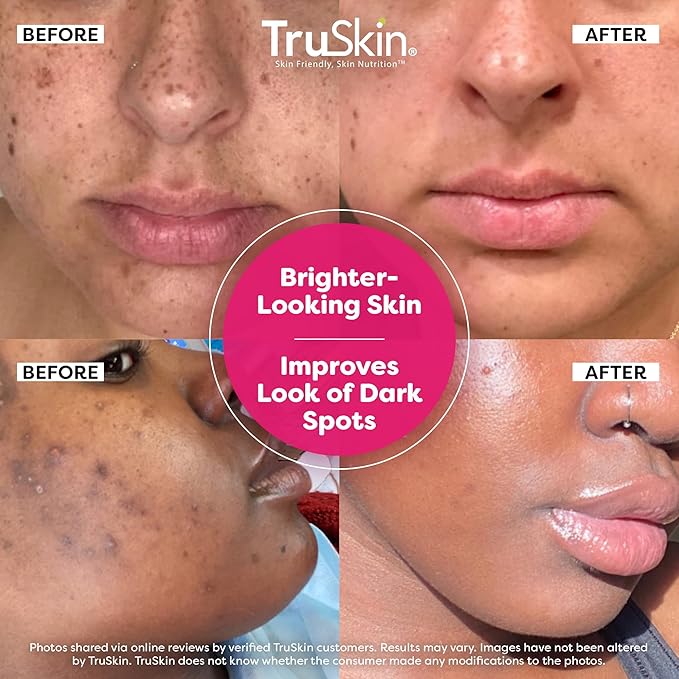 TruSkin Vitamin C Super Serum - Niacinamide Retinol Hyaluronic Acid &amp Squalane - All-in-One Anti Aging Serum for Face ? Improve Appearance of Dark Spots Firmness for Brighter Looking Skin 1 Fl