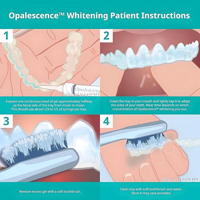 Opalescence 20% Teeth Whitening Refill Kit (4 Syringes) Carbamide Peroxide. Made by Ultradent in Mint Flavor. Tooth Whitening Refill Syringes - B-5196-4