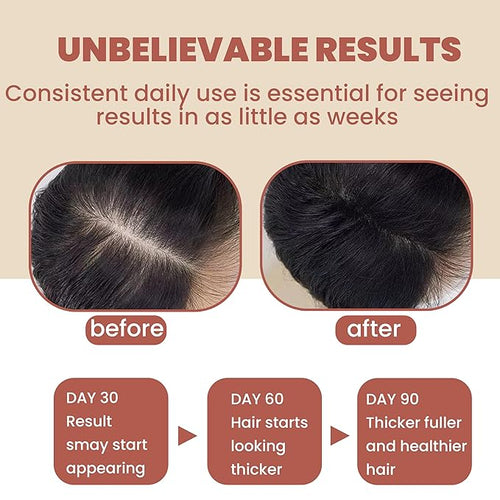 100% Raw Batana Oil for Hair Growth Mask with Biotin &amp Bamboo Extract - Natural Scalp Revitalizer for Thicker Fuller Hair - Anti-Hair Loss (1pcs)