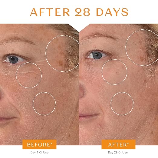 Yon-Ka Vitamin C Face Serum | Anti-Aging Face Serum for Sensitive Skin | High Concentrate to Treat Wrinkles &amp Uneven Skin Texture
