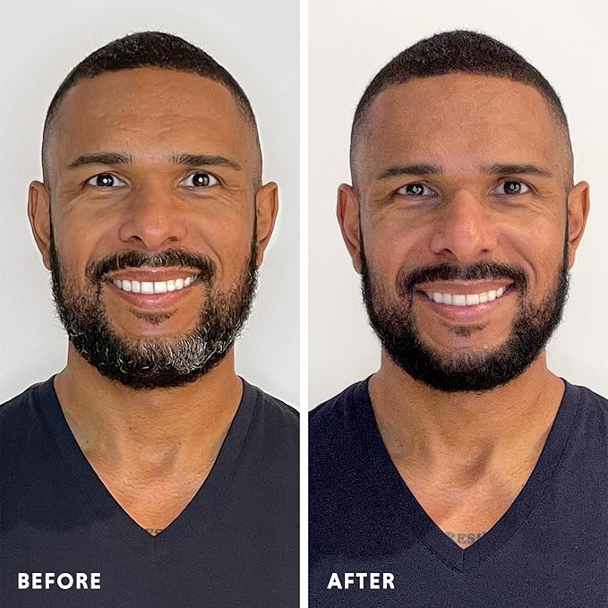 Hair &amp Beard Color for Full Gray Coverage 2 pack - Medium Ash Blonde - Ammonia-Free Complete Men?™s At-home Beard &amp Hair Dye Kit Professional-grade Permanent Hair Color (8.1)