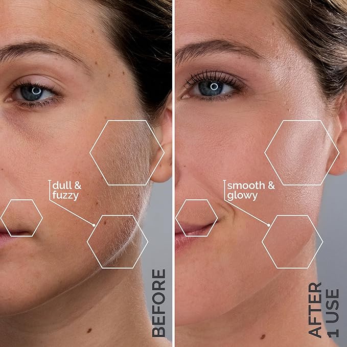 SPA SCIENCES - SIMA Patented Dermaplane Razor for Women Face ? Painless 2-in-1 Facial Exfoliation &amp Peach Fuzz Hair Removal ? Anti-Aging ? 3 Speeds ? Rechargeable ? 19 Weeks Treatment