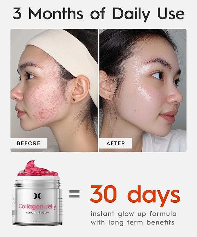 REVO Collagen Jelly ? Korean Anti-Aging Plumping Formula with Hydrolyzed Collagen Niacinamide Hyaluronic Acid &amp Vitamin C ? Skincare for Glass Glow Skin Wrinkle Repair &amp Even Tone (3.52 Fl