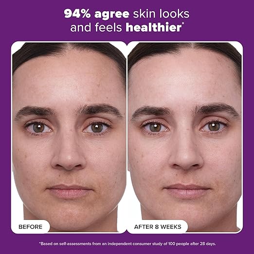 Paula's Choice CLINICAL 1% Retinol Face Moisturizer Treatment with Peptides Vitamin C &amp Licorice Extract Firming Face Cream Anti-Aging &amp Wrinkles Fragrance Free