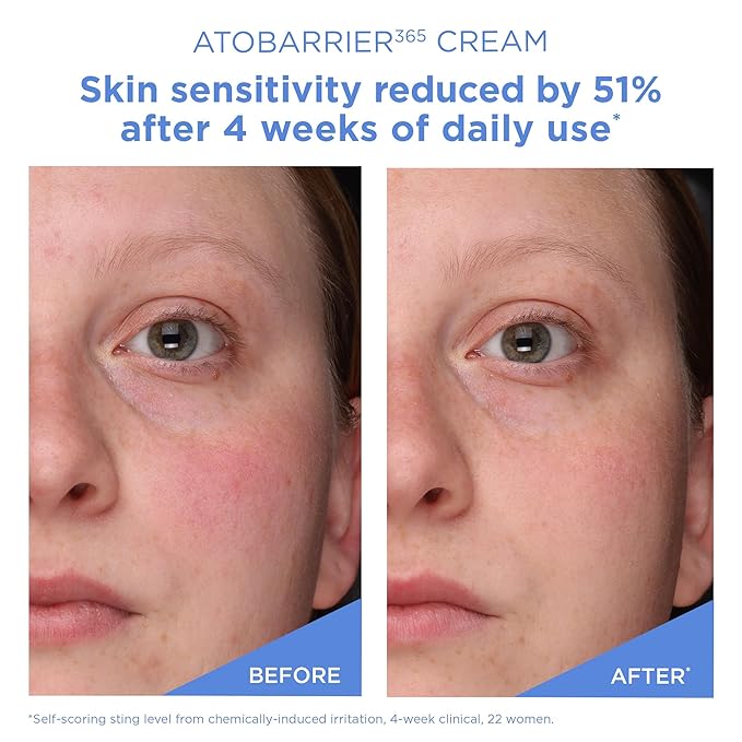 AESTURA ATOBARRIER365 Cream with Ceramides Korean Face Moisturizer for Barrier Repair | 120H lasting Hydration Ceramide Capsules Dry &amp Sensitive Skin Non-comedogenic 80 mL / 2.70 fl.oz.