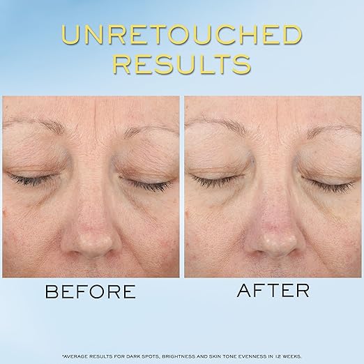 Lanc?me Supra Screen Invisible Serum Sunscreen SPF 50+ - Anti-Aging Correction &amp Protection - For All Skin Types - 48 HR Hydration Radiant Finish