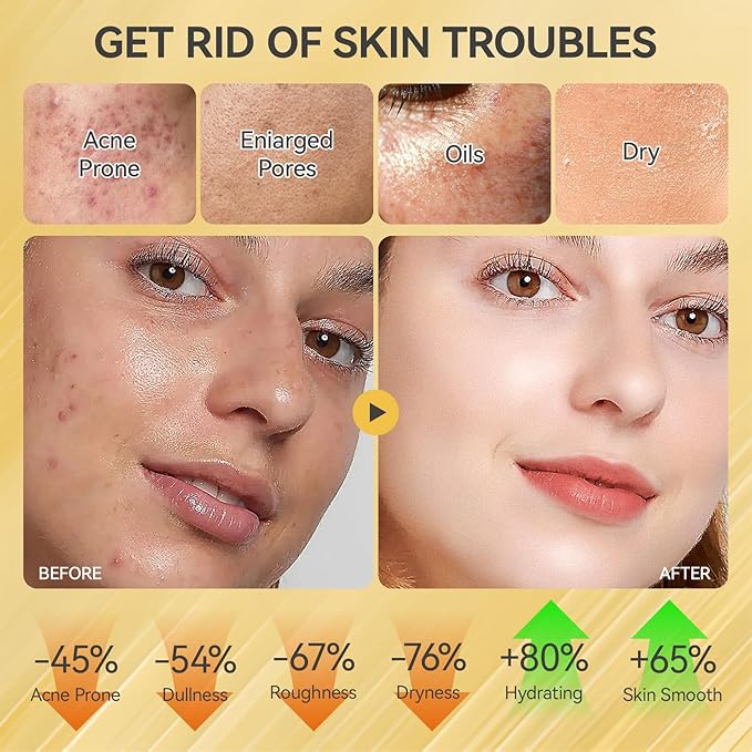 Skin Care Set Face Snail Revitalizing Skin Care Sets &amp Kits Facial Beauty Skincare Gifts for Teenage Girls with CleanserTonerSerumEye CreamFace Cream Firming Hydrating Skin Care Christmas G