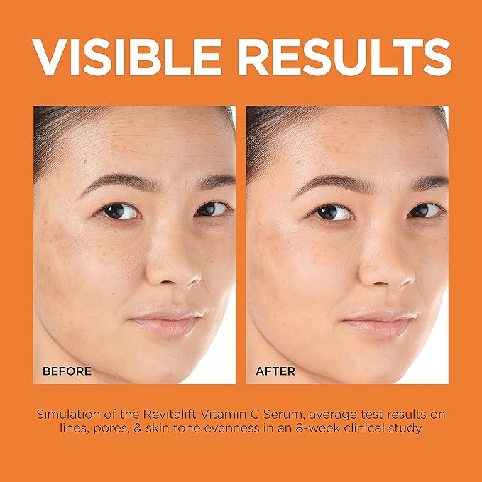 L'Oreal Paris Revitalift 12% Pure Vitamin C Serum Brightening Serum For Face with Vitamin E Salicylic Acid 1 oz + Moisturizer Sample
