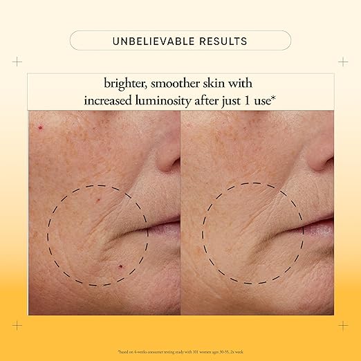 philosophy microdelivery vitamin c resurfacing peel kit - with lactic acid &amp sunflower seed oil - two-step treatment to smooth rough texture even skin tone and minimize the appearance of fine lin